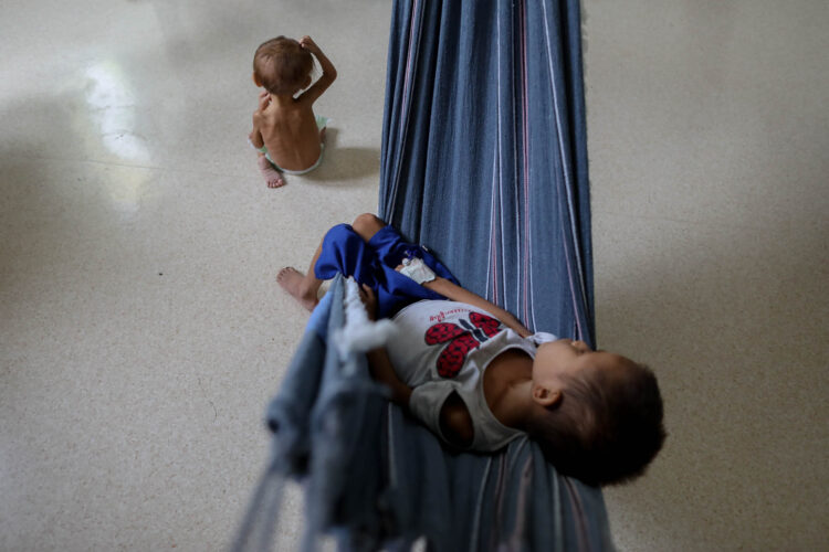 Crianças Yanomami com sinais de desnutrição são atendidas no Hospital da Criança, em Boa Vista. Foto: Michael Dantas/AFP