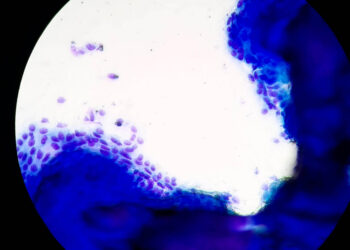 O que não é nada também pode ser belo