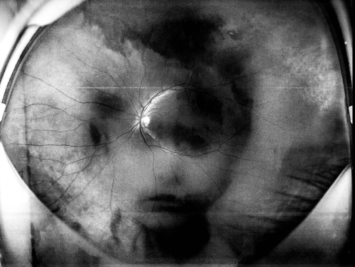 Retinografias – Anatomia do Olhar