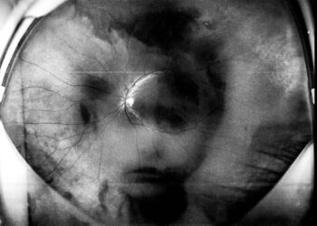 Retinografias – Anatomia do Olhar