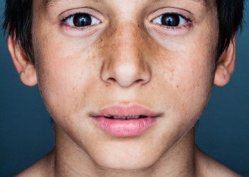 El Clot – The Twins Pportrair (Juan)